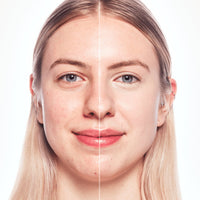 essence Camouflage + Healthy Glow Concealer | 2 Shades essence Cosmetics